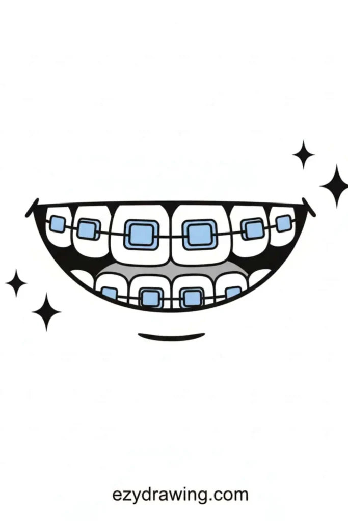 Cute wide smile drawing with blue braces on the teeth and sparkly accents around it